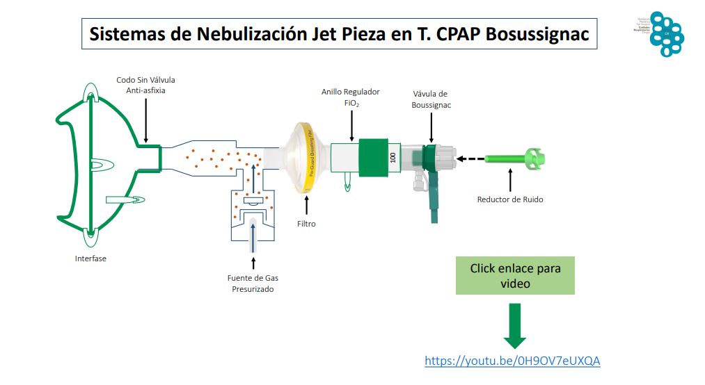 versatilidad de la CPAP de Boussignac