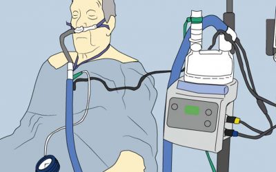 CPAP vs Alto Flujo: ¿por qué elegir si las puedes combinar con mejores resultados?