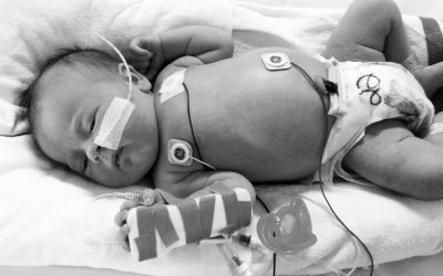 Gestión del capital venoso en neonatos: selección del catéter y calibre adecuado