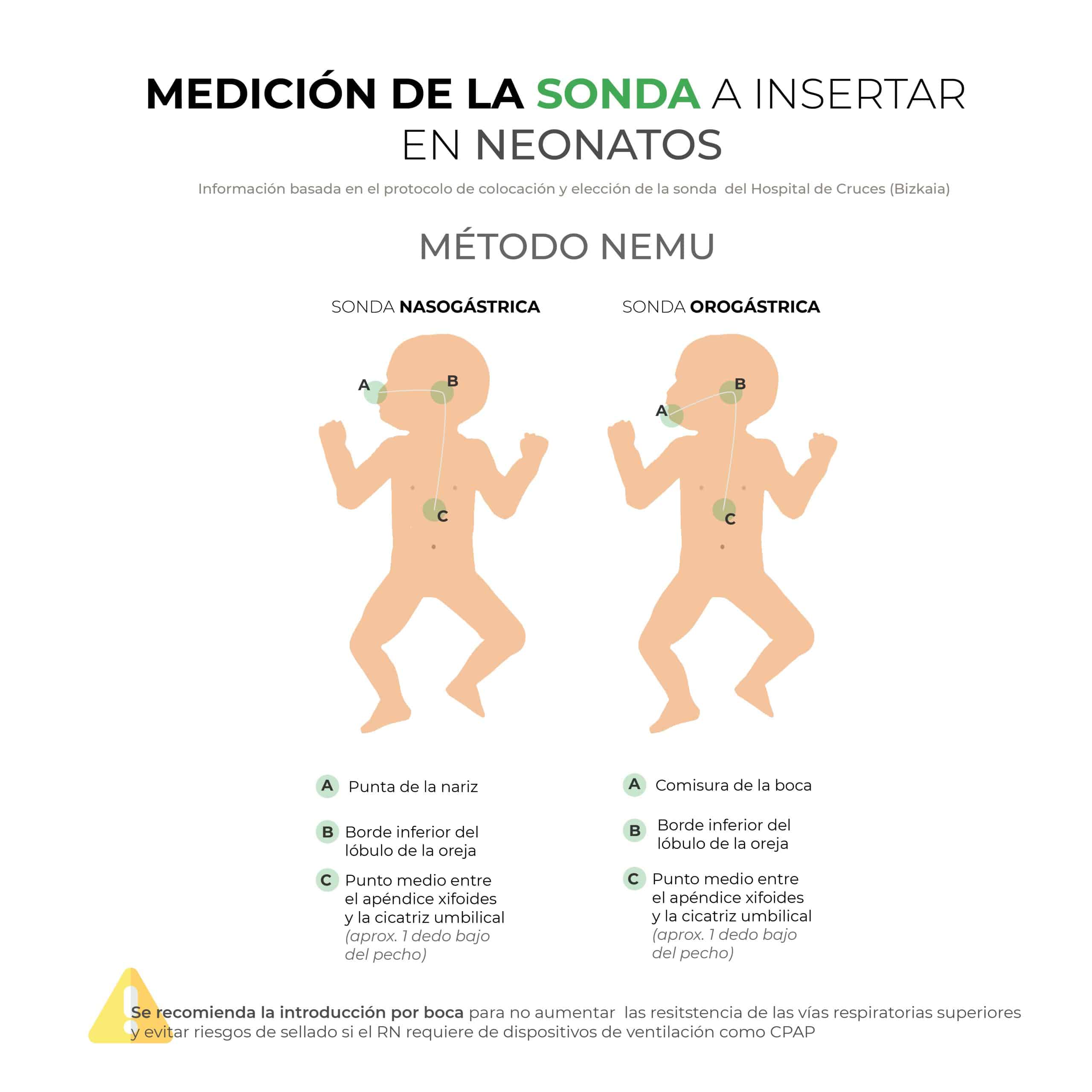 Medición de la sonda a insertar en neonatos: método NEMU