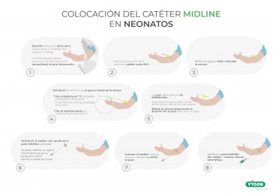 Colocación de catéter midline en neonatos
