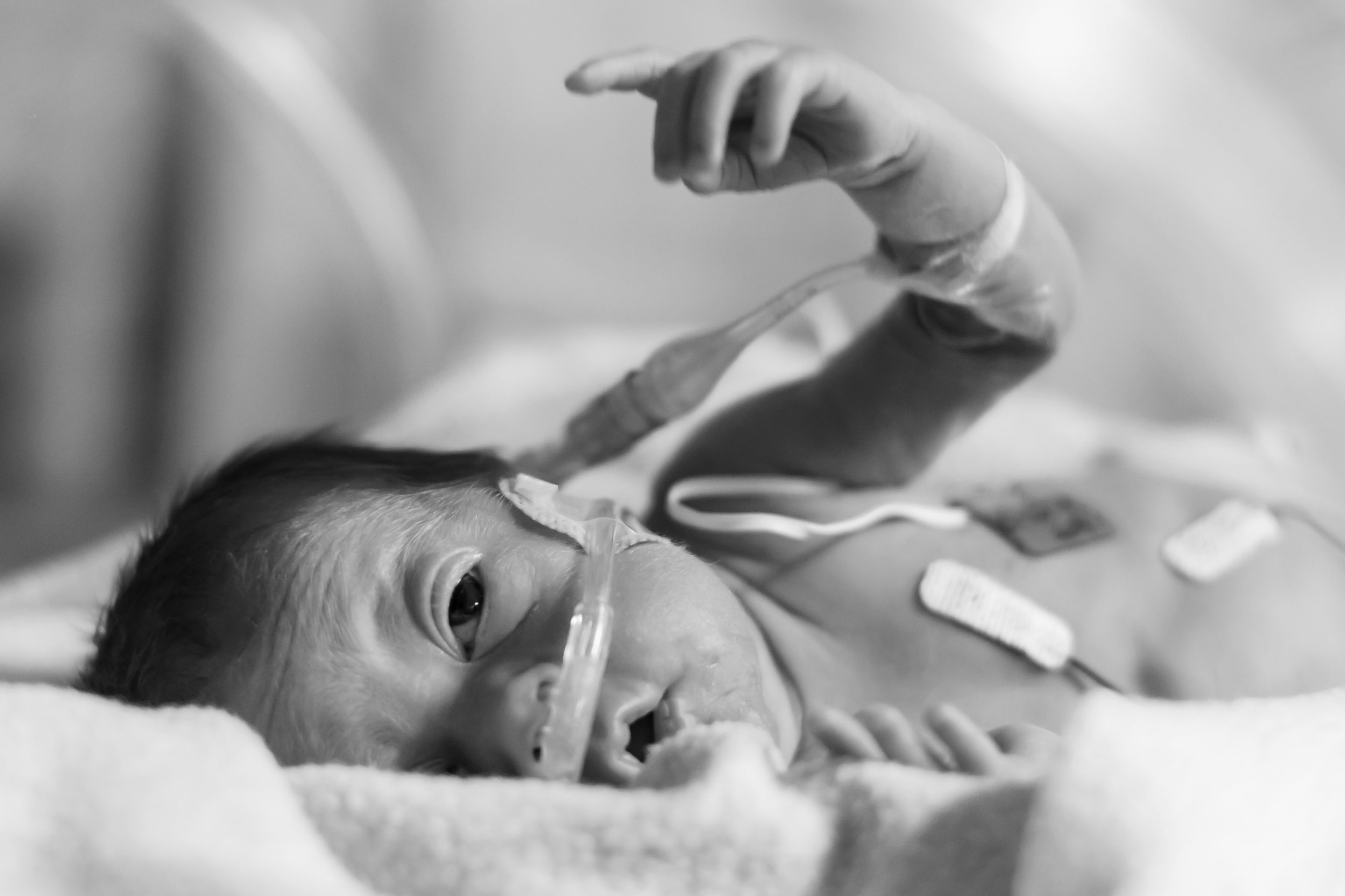 20 consejos sobre el PICC neonatal que debes conocer